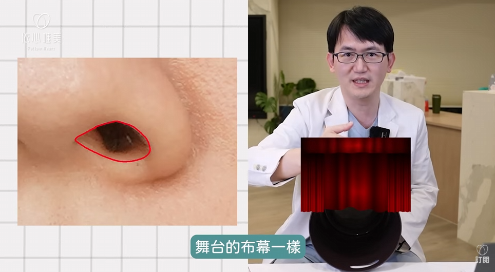 要理解露鼻孔，可以先把鼻孔想像成一座舞台。鼻翼就像舞台前方的布幕，而鼻孔地板則是舞台本身。