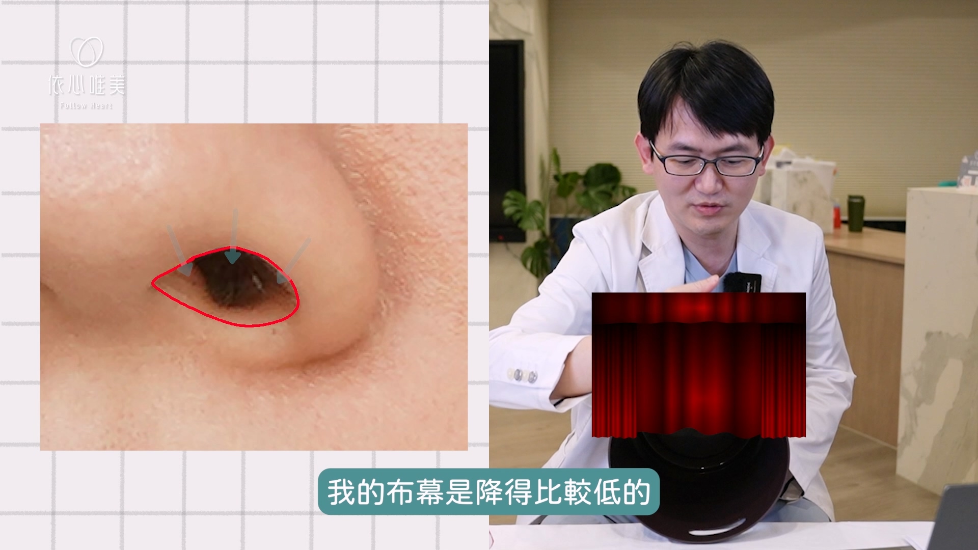 如果鼻翼邊緣的位置相對偏低，就像舞台布幕放得比較低，從正面看，自然比較不容易看到深處的鼻孔。