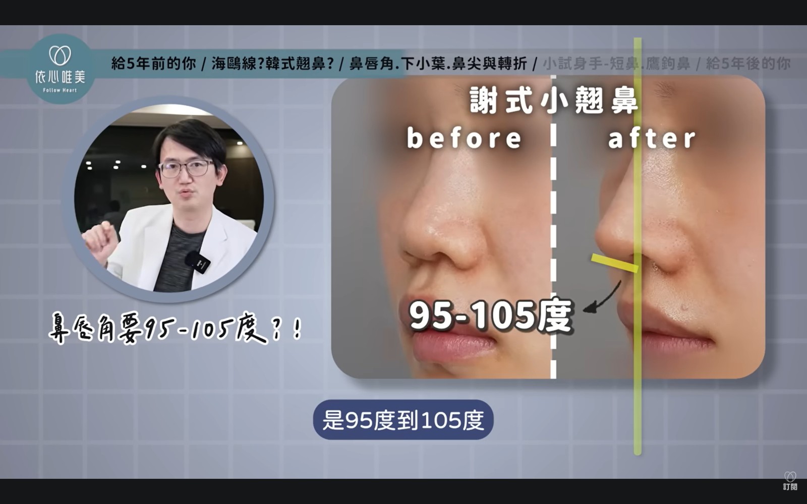 除了鼻唇角之外，謝東穎醫師還會綜觀鼻子與嘴唇、下巴和整體側臉輪廓的關係。