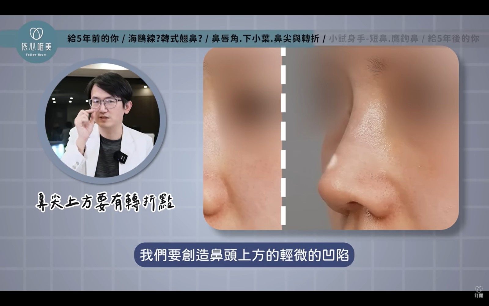 鼻尖上方這個位置常被稱為鼻尖上轉折點。