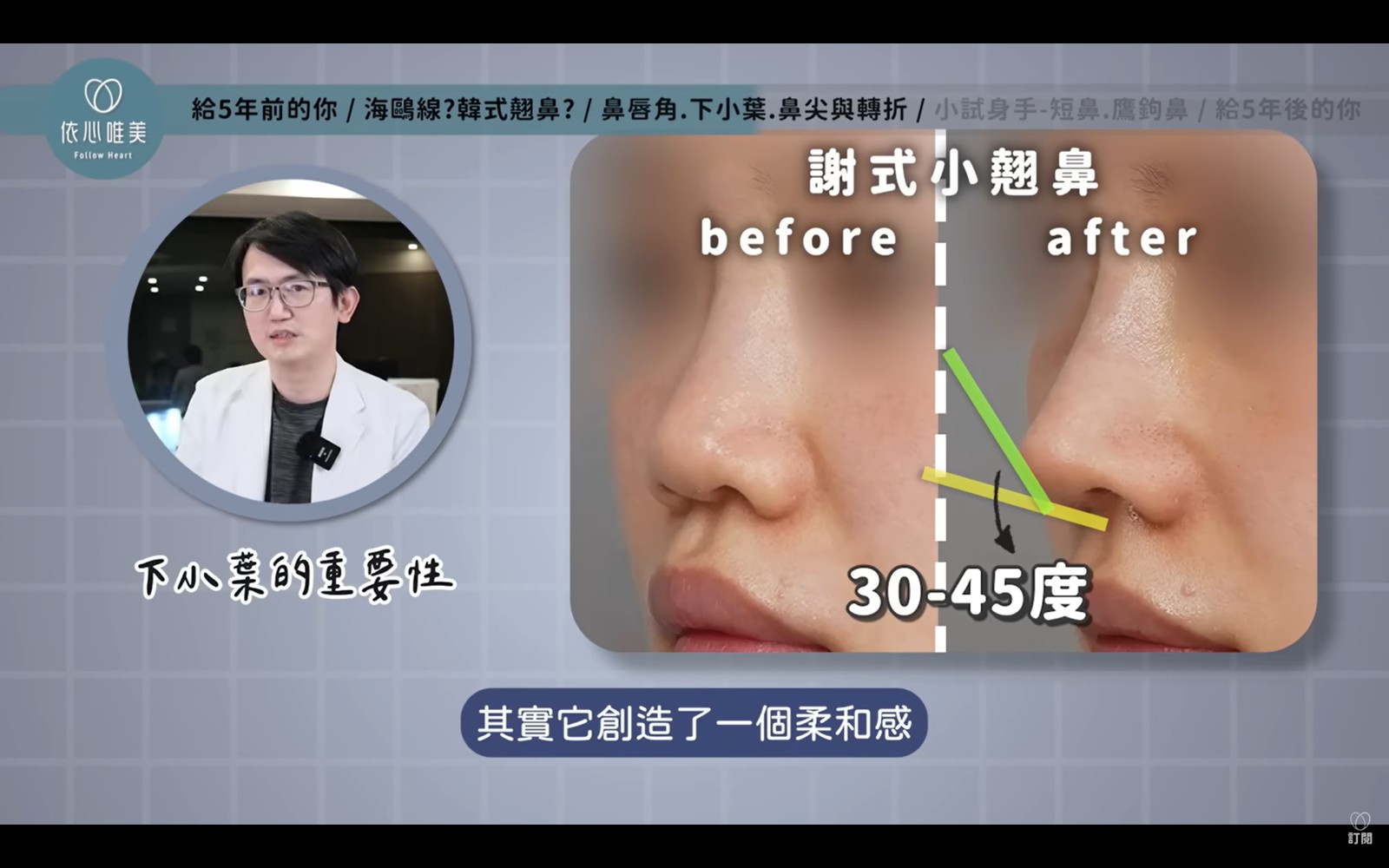 從鼻背的轉折、鼻尖表現點，到下小葉與鼻小柱，每個位置都需要彼此銜接。